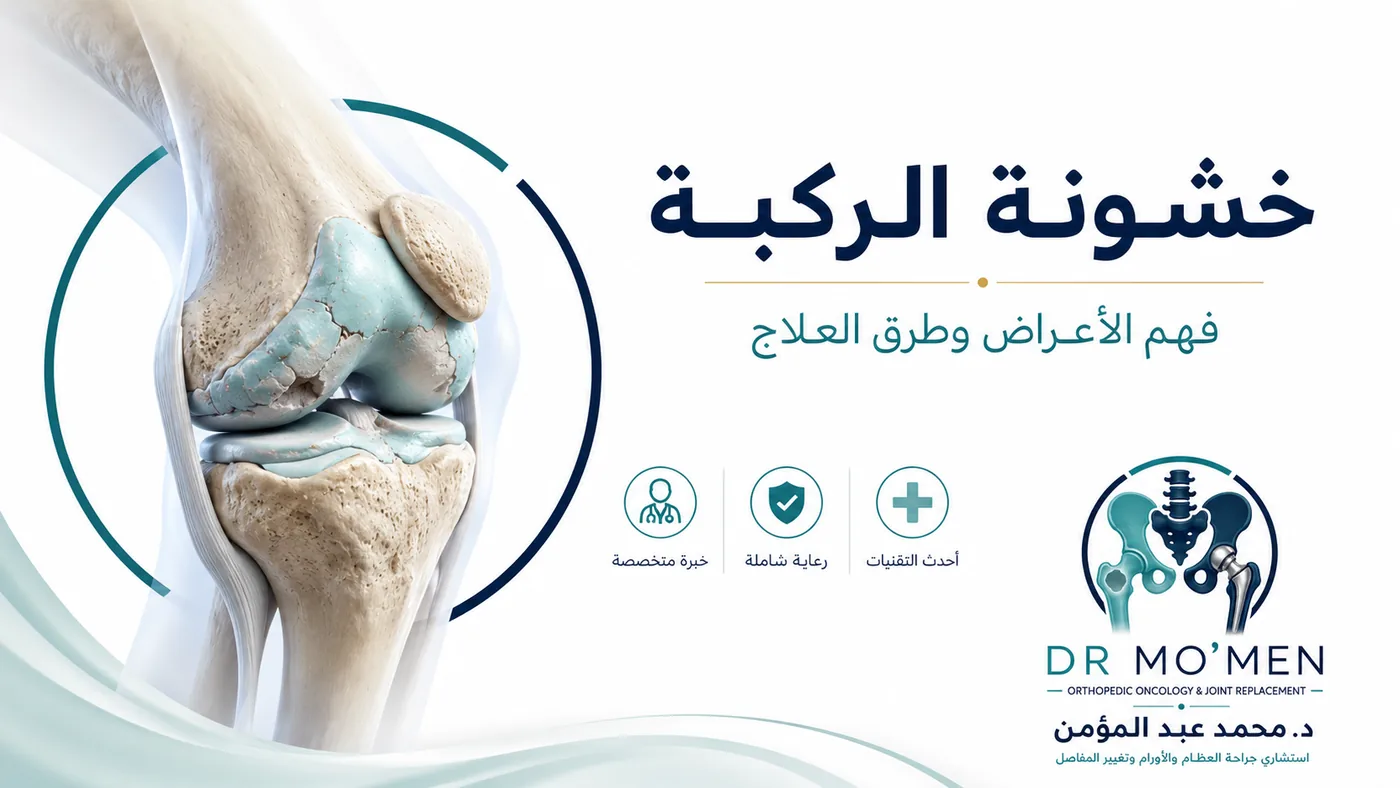 خشونة الركبة ومتى تكفي الأدوية والحقن ومتى نحتاج تغيير مفصل الركبة