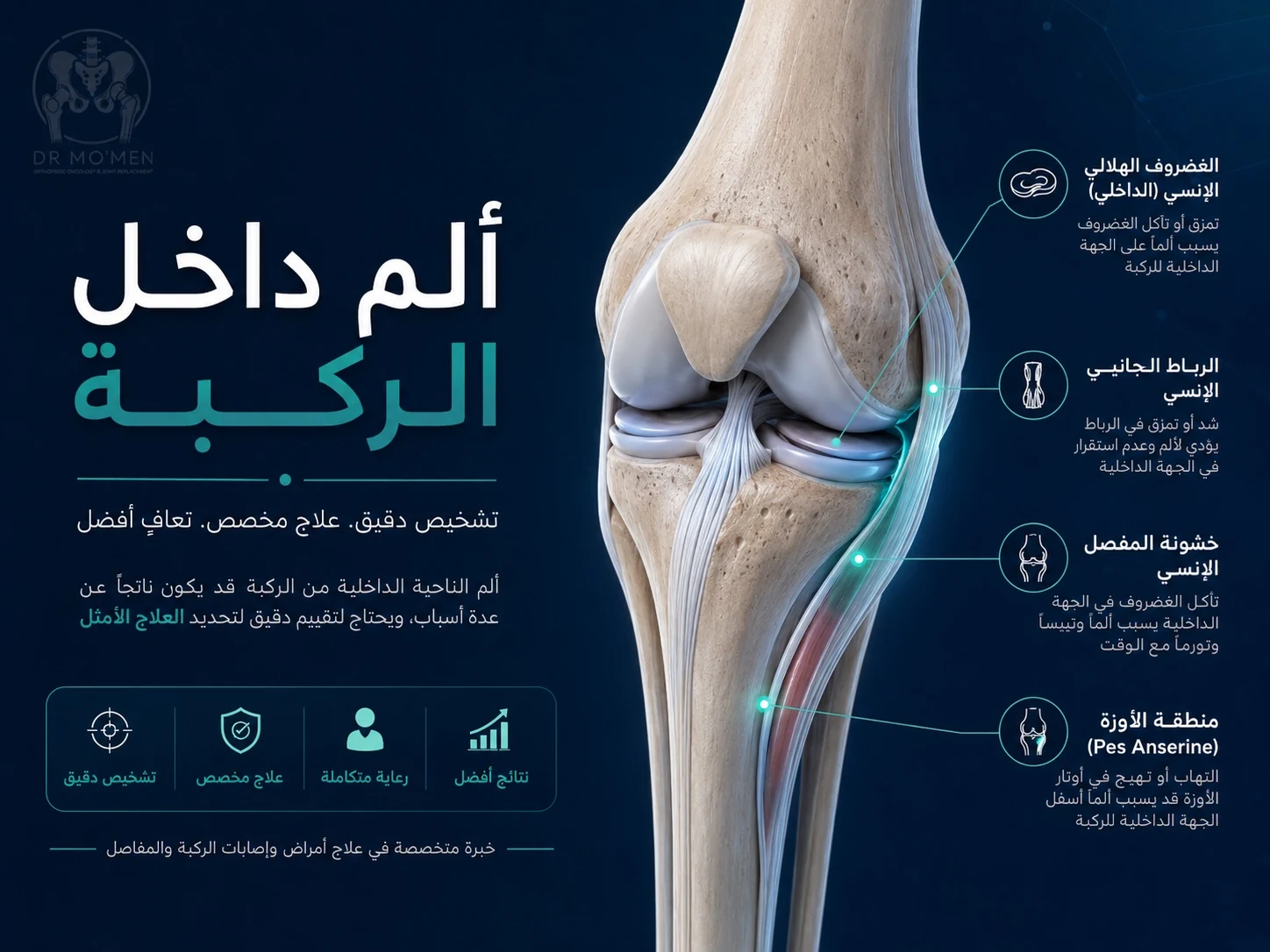 رسم طبي يوضح أسباب ألم داخل الركبة مثل الغضروف الهلالي الداخلي وخشونة الركبة