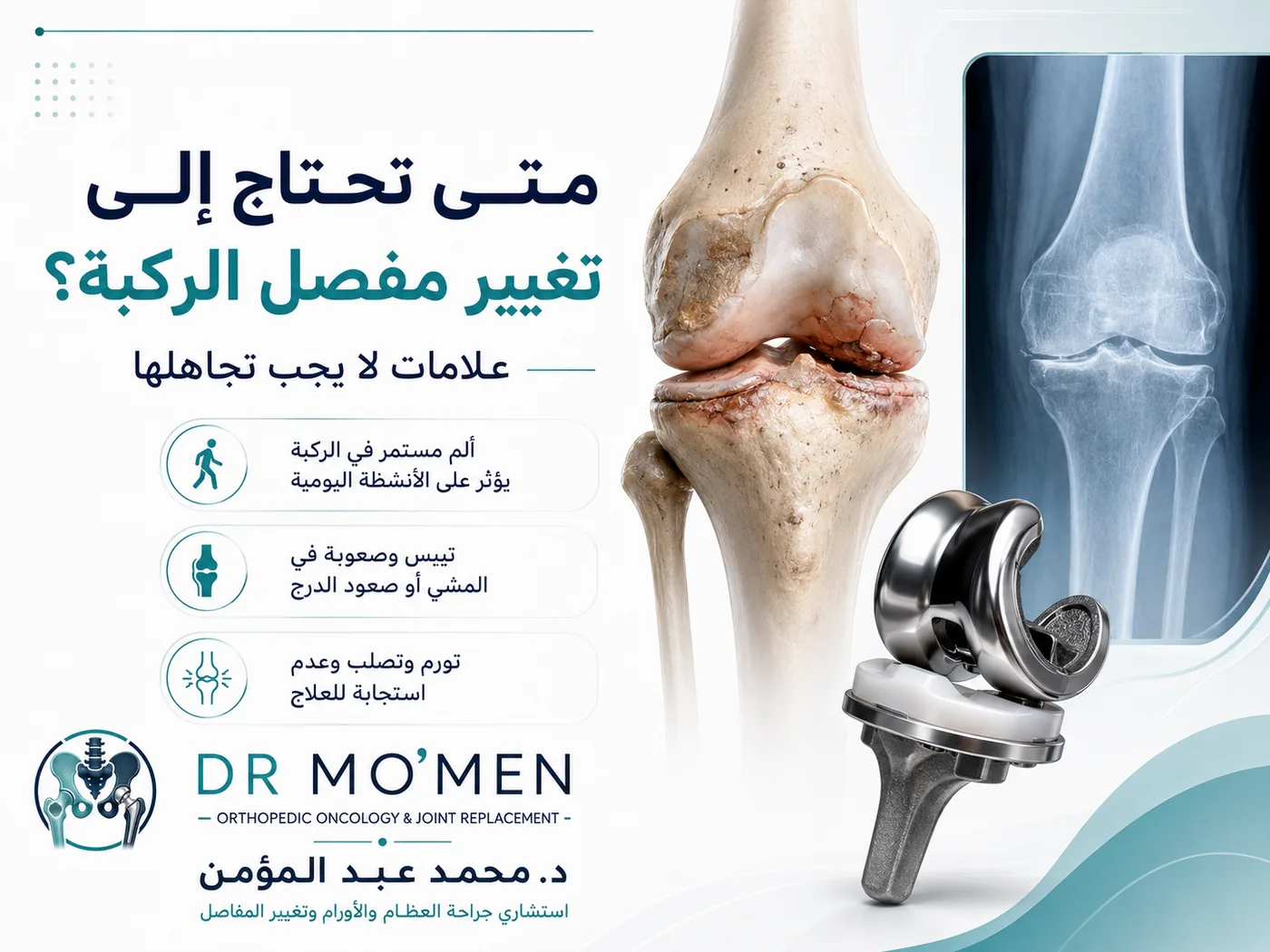 تغيير مفصل الركبة لعلاج خشونة الركبة المتقدمة وتقليل الألم وتحسين الحركة