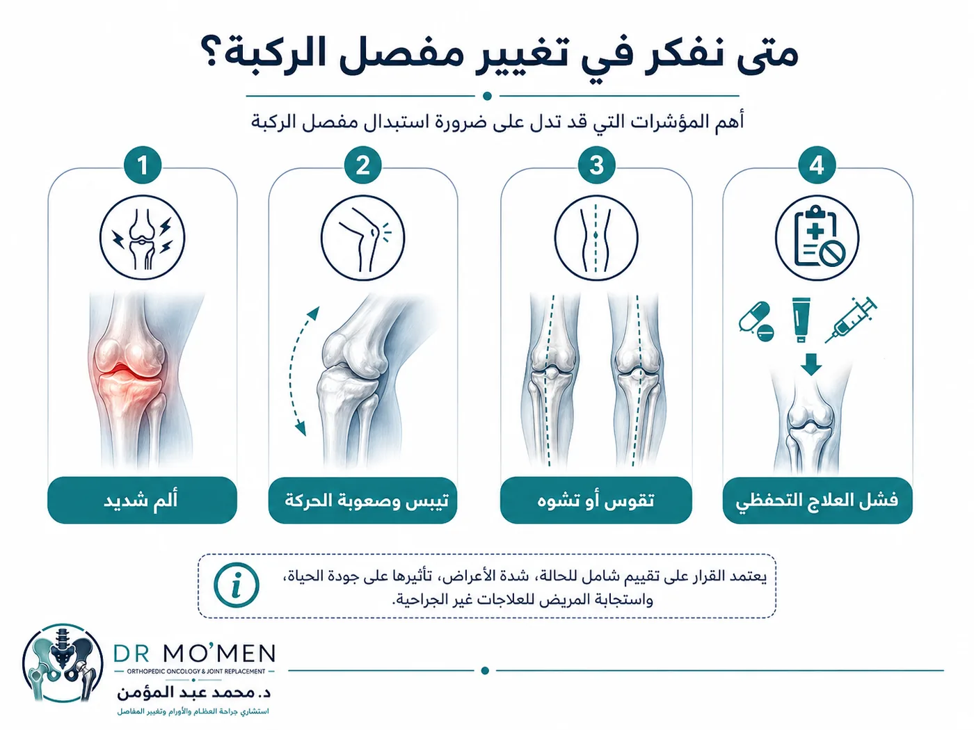 علامات الحاجة إلى تغيير مفصل الركبة مثل الألم والتيبس والتقوس وفشل العلاج التحفظي