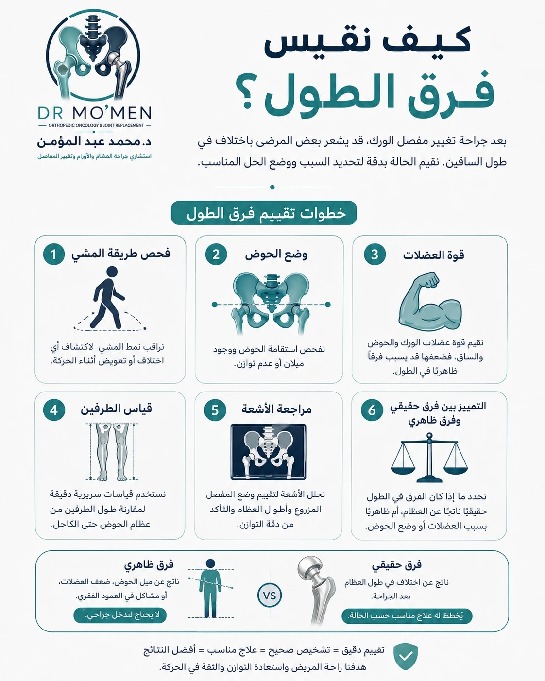 تقييم فرق طول الرجل بعد تغيير مفصل الفخذ بالفحص وطريقة المشي والأشعة