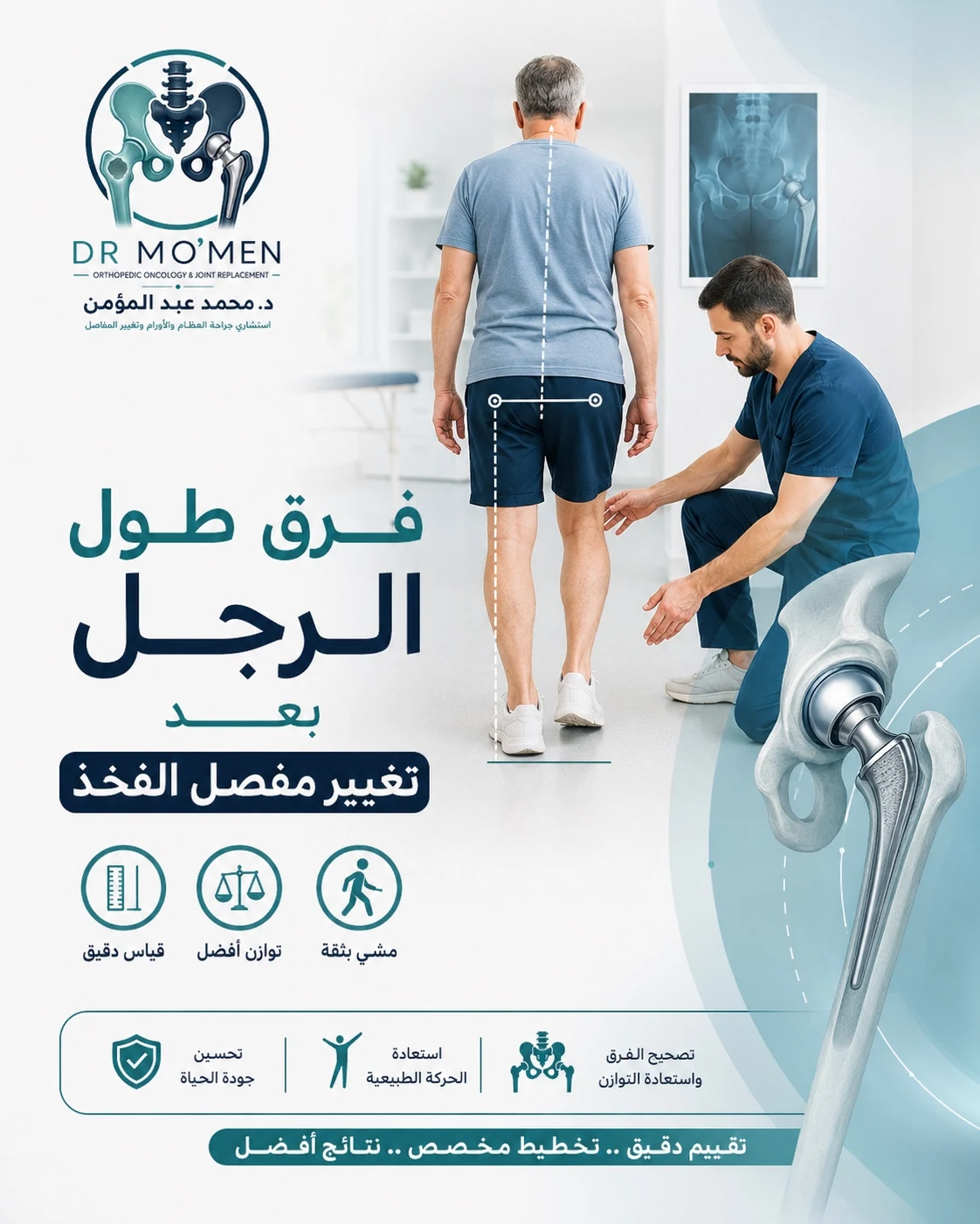 فرق طول الرجل بعد تغيير مفصل الفخذ ومتى يكون طبيعيًا أو يحتاج تقييم الطبيب