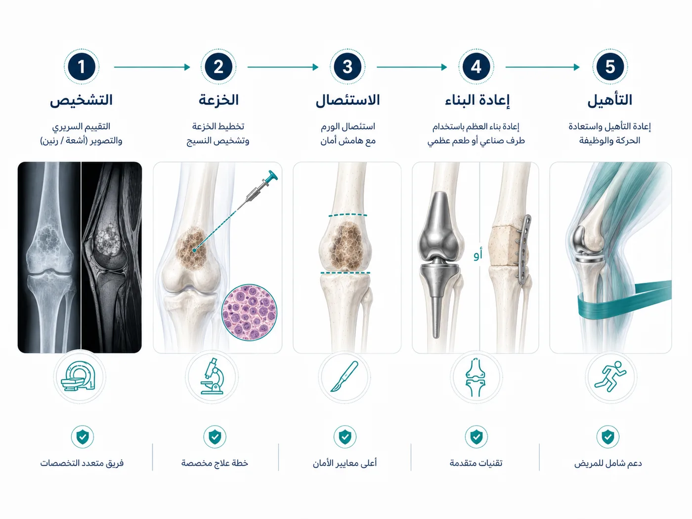 مراحل علاج أورام العظام من التشخيص والخزعة إلى إنقاذ الطرف والتأهيل