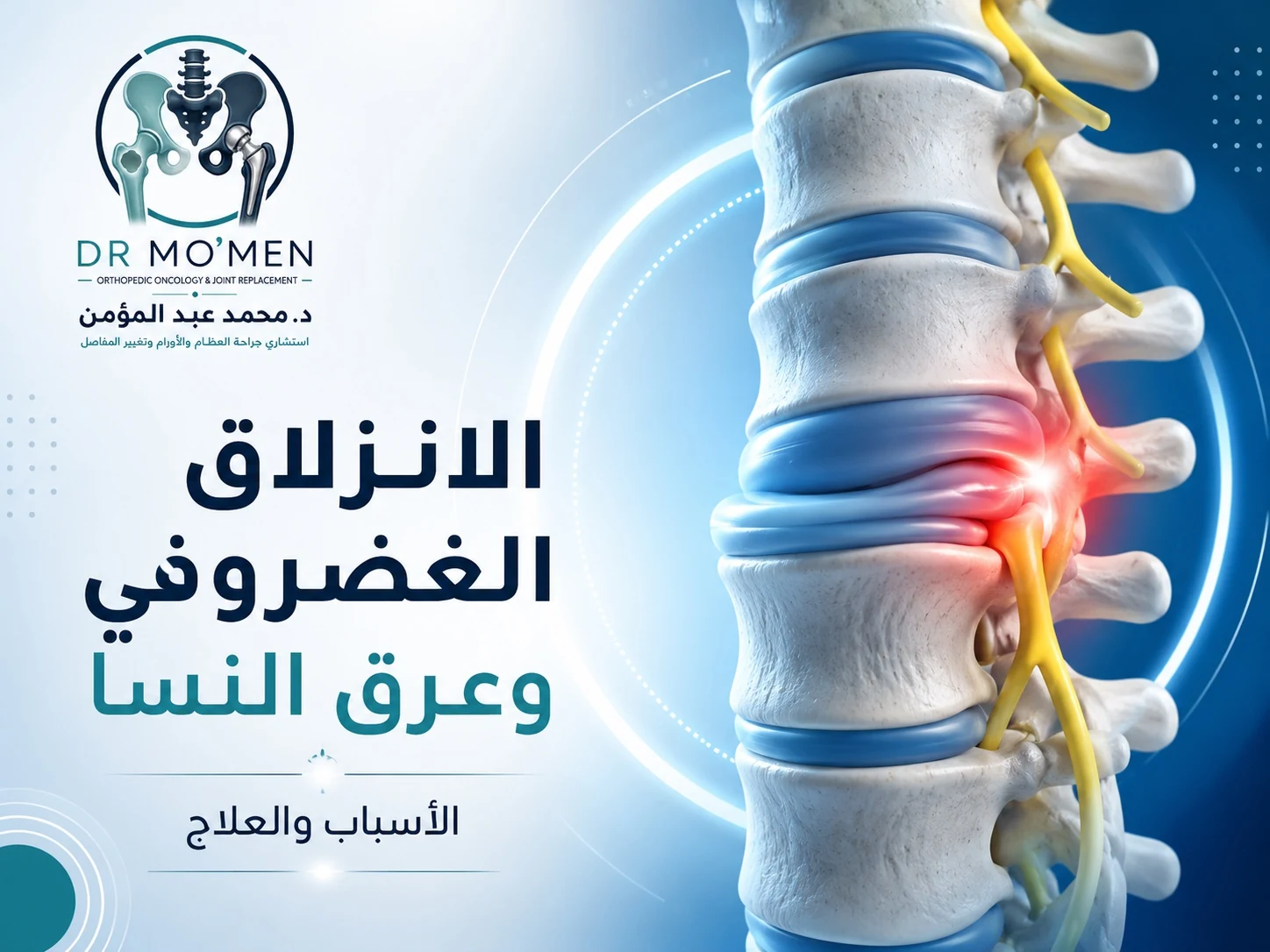 الانزلاق الغضروفي القطني وعرق النسا وأسباب ألم أسفل الظهر وخيارات العلاج