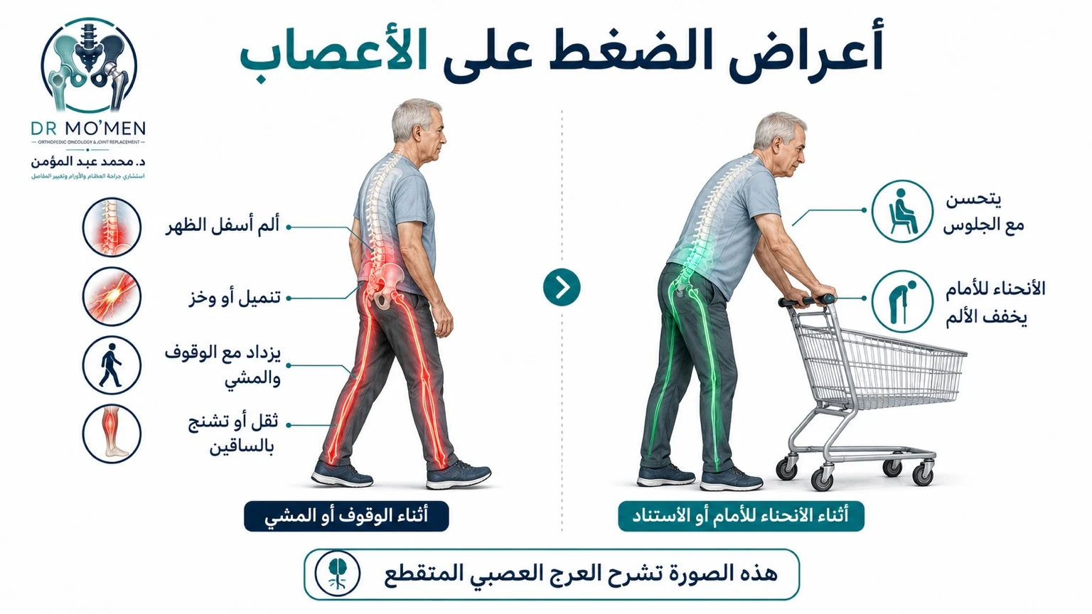 إنفوجرافيك يوضح أعراض العرج العصبي وألم الساقين مع المشي