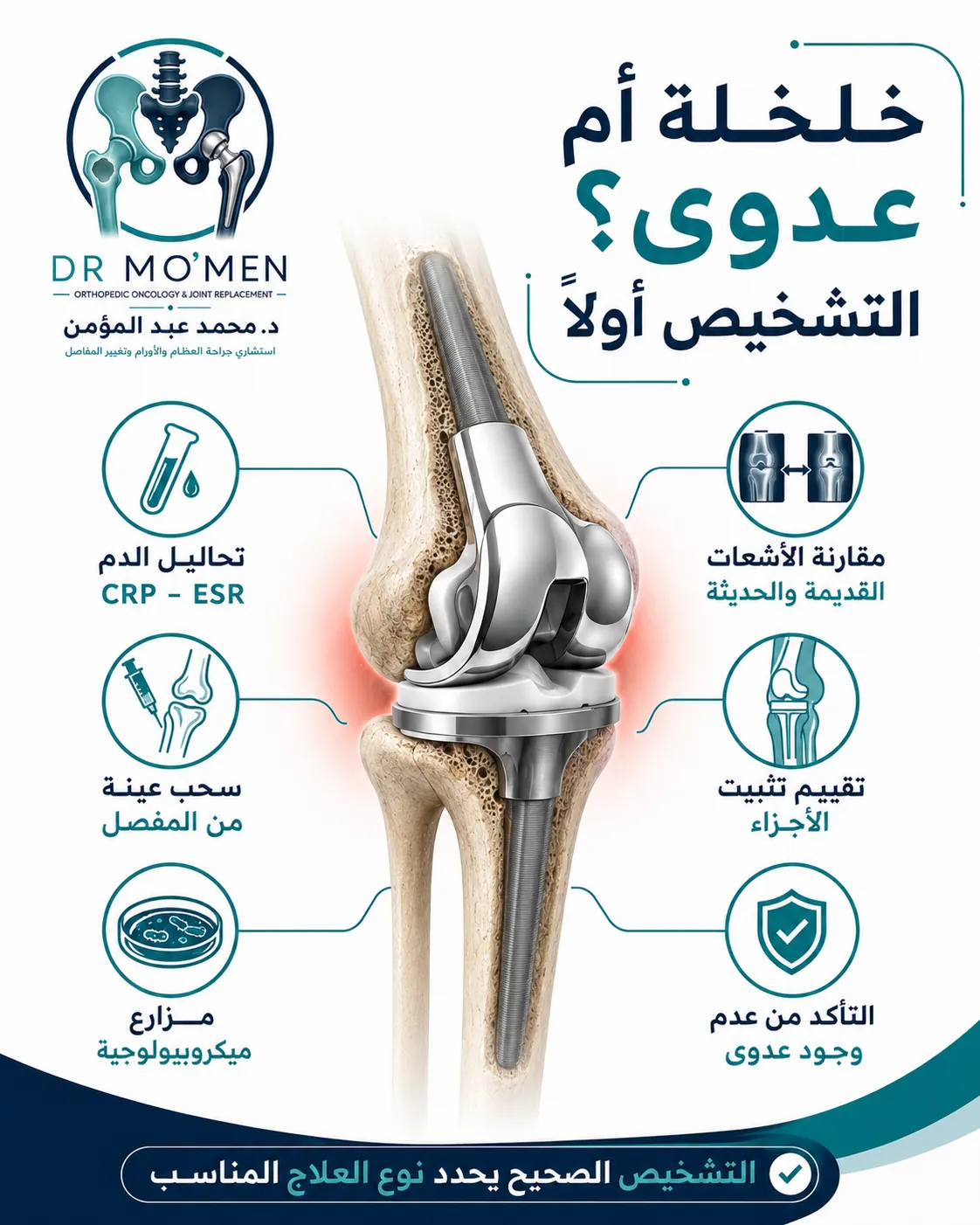 خطوات التفريق بين خلخلة المفصل الصناعي الضخم والعدوى