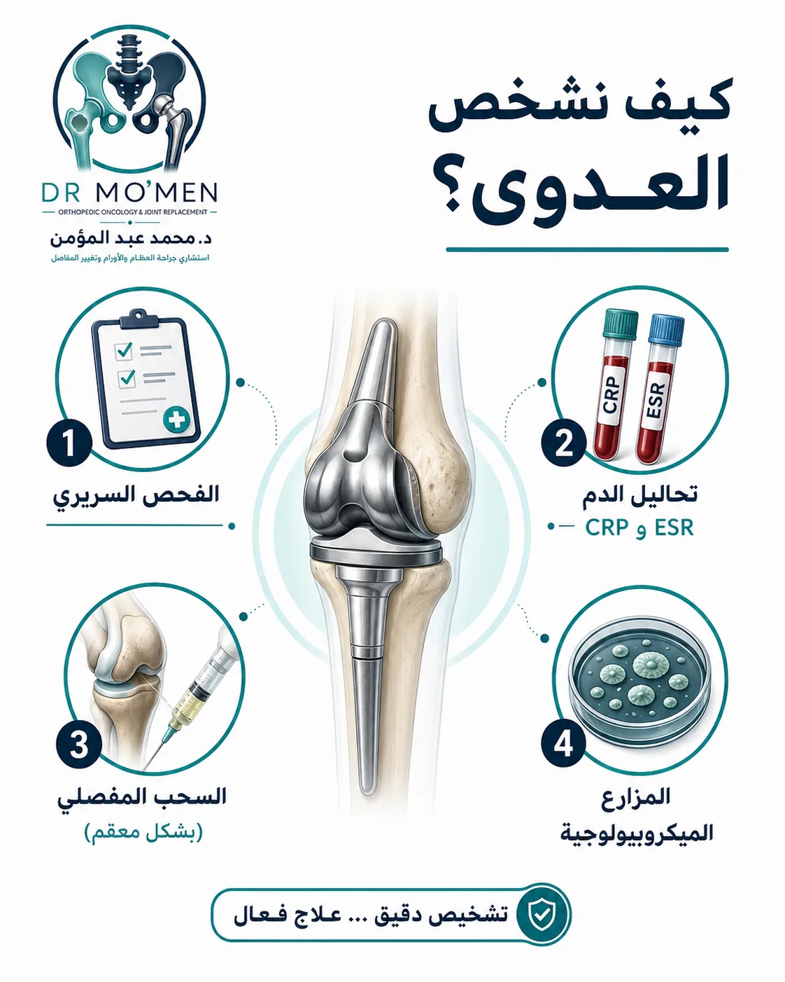 خطوات تشخيص العدوى حول المفصل الصناعي الضخم بالفحص والتحاليل وسحب العينة والمزارع