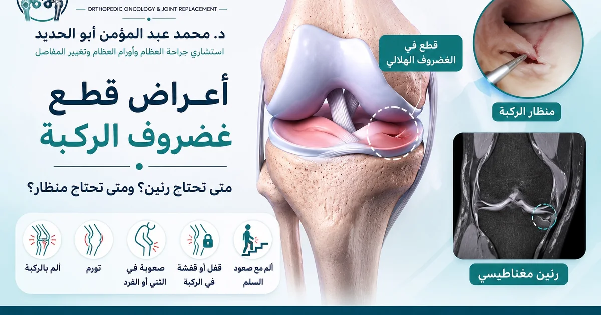 أعراض قطع غضروف الركبة أعراض قطع غضروف الركبة ومتى تحتاج رنين أو منظار لعلاج الغضروف الهلالي