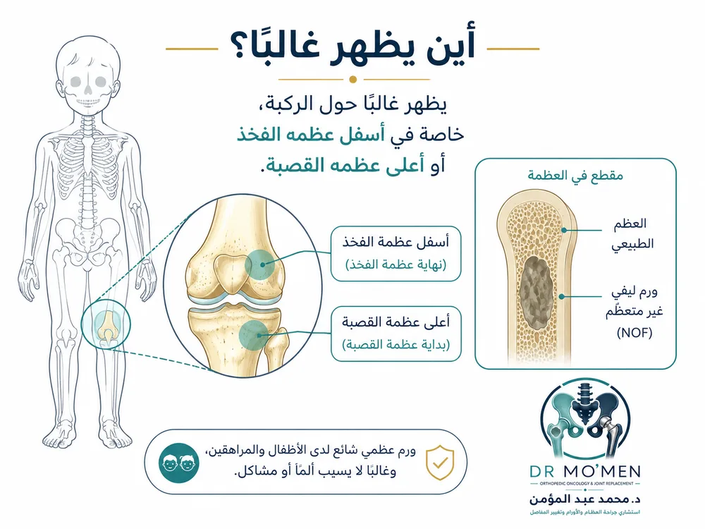 الورم الليفي غير المتعظم NOF عند الأطفال — صورة توضيحية داخل المقال رقم 2