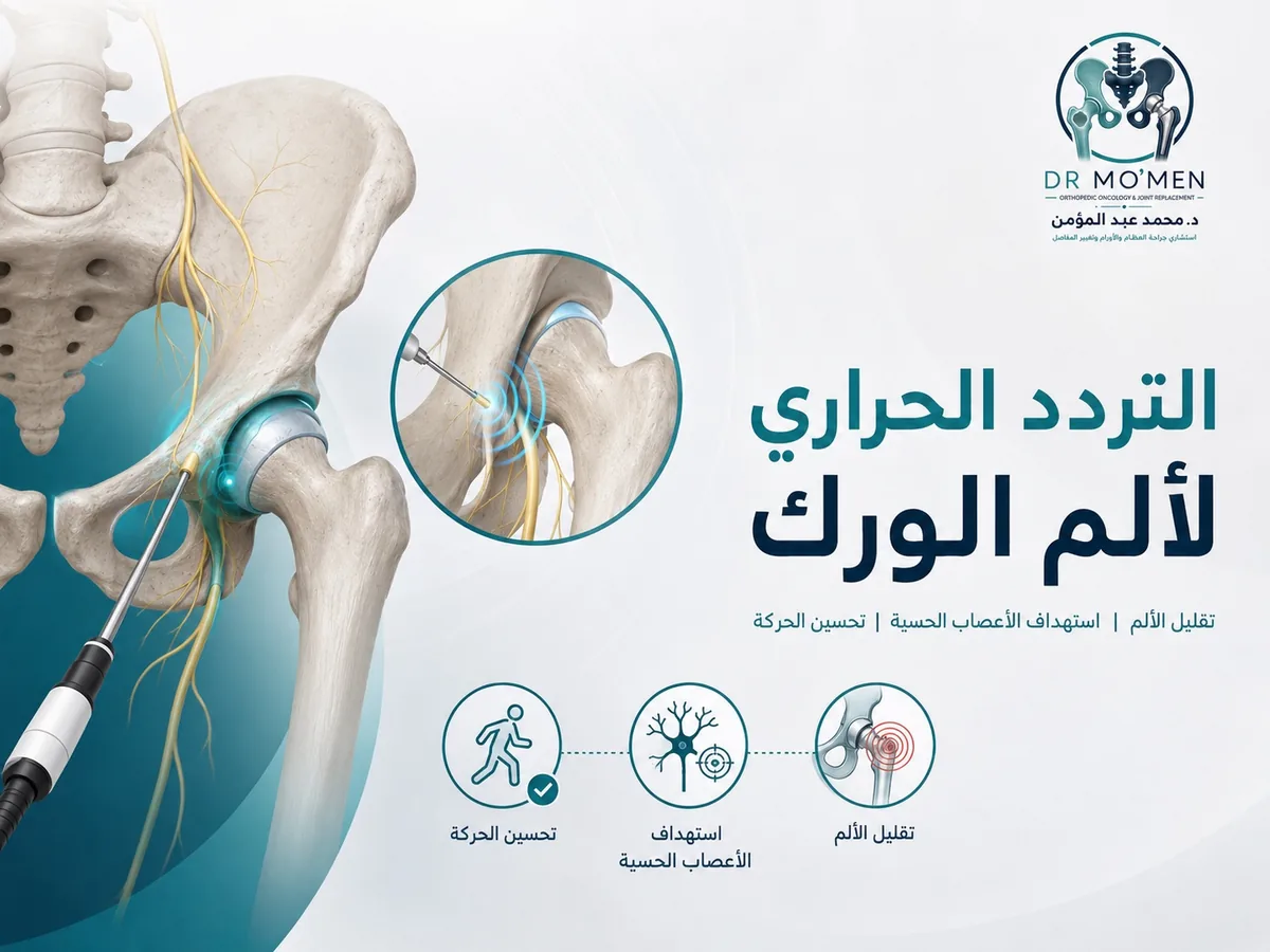 التردد الحراري لعلاج ألم مفصل الورك المزمن في الحالات غير المناسبة للجراحة