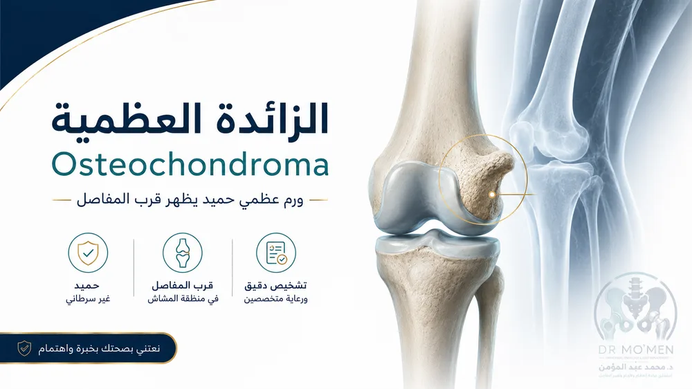 بروز عظمي حميد Osteochondroma قرب مفصل الركبة عند مراهق