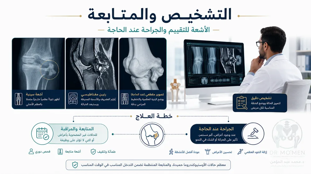 تشخيص الزائدة العظمية بالأشعة والرنين قبل قرار الجراحة