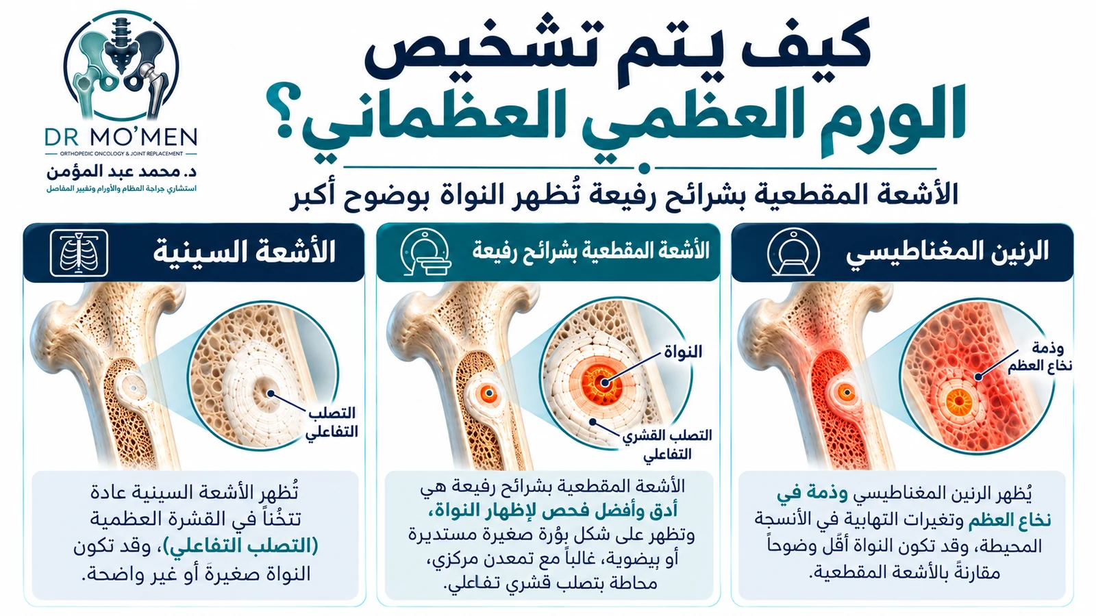 رسم توضيحي يقارن الأشعة السينية والأشعة المقطعية بشرائح رفيعة والرنين المغناطيسي في تشخيص الورم العظمي العظماني.