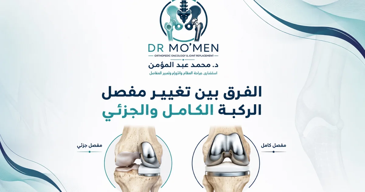 الفرق بين تغيير مفصل الركبة الكامل والجزئي ومتى يناسب كل نوع