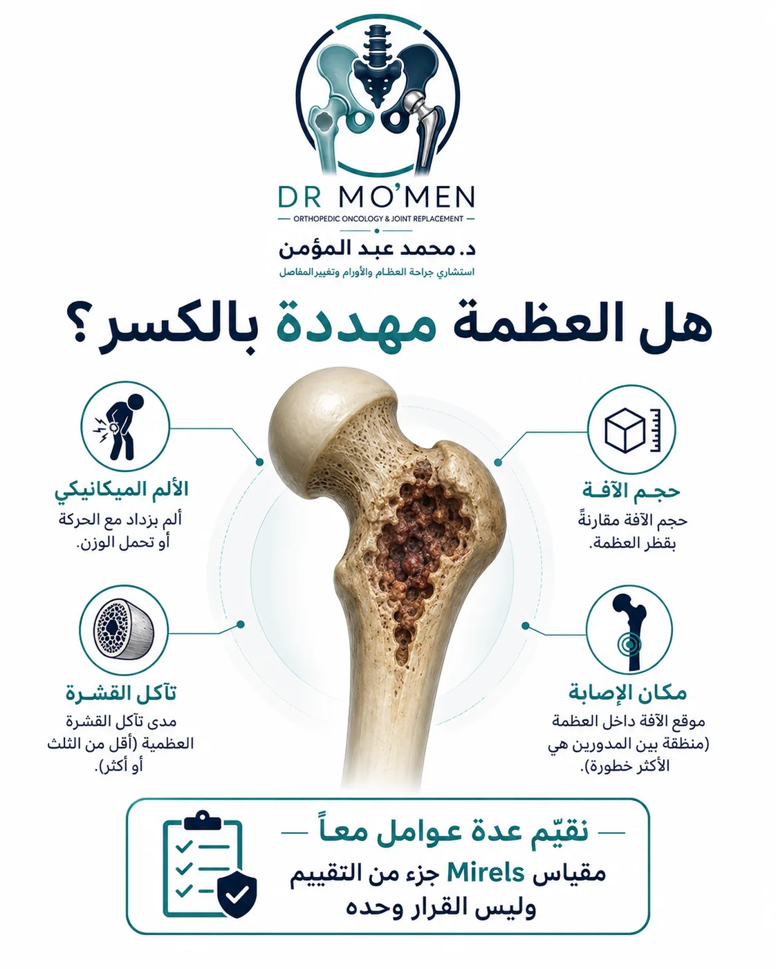 مقياس Mirels لتقييم خطر الكسر في انتقالات العظام من خلال المكان ونوع الآفة والحجم والألم
