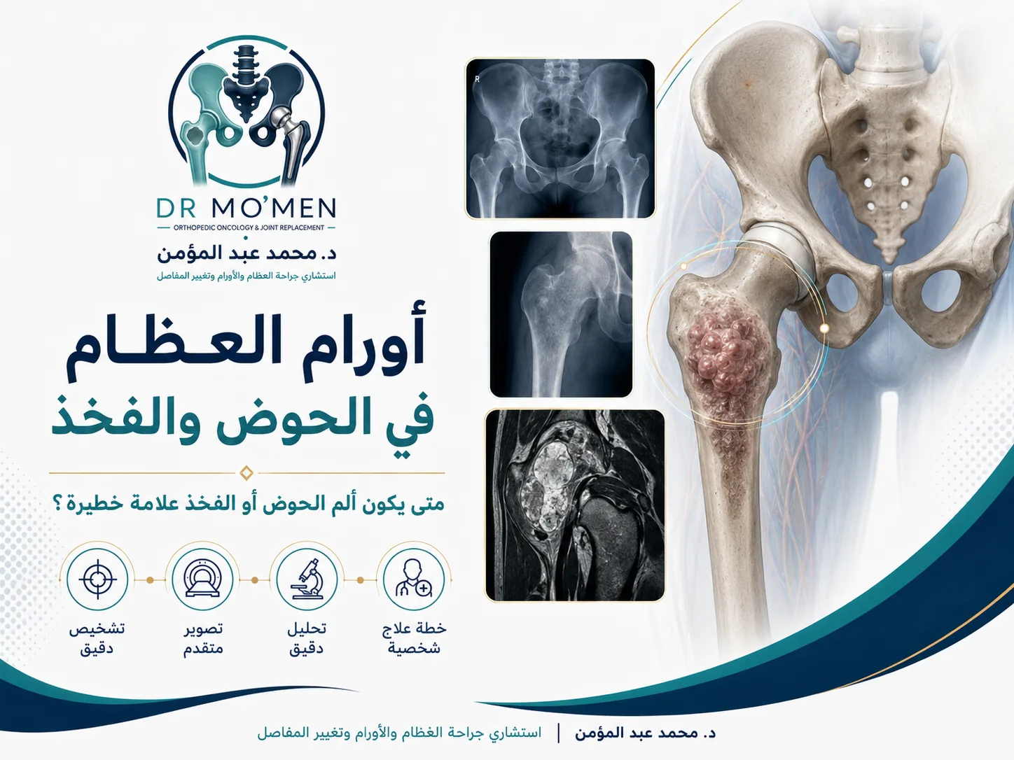 أورام العظام في الحوض والفخذ ومتى يكون ألم الحوض أو الفخذ علامة خطيرة