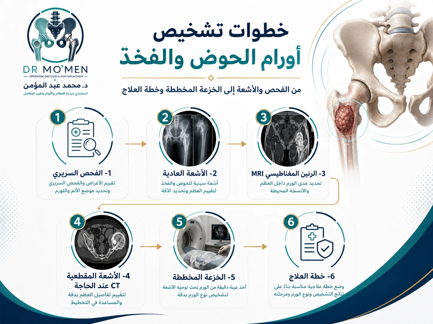 خطوات تشخيص أورام العظام في الحوض والفخذ من الفحص والأشعة إلى الرنين والخزعة المخططة