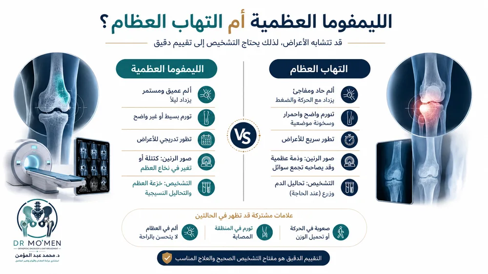 الليمفوما العظمية الأولية — صورة توضيحية داخل المقال رقم 2