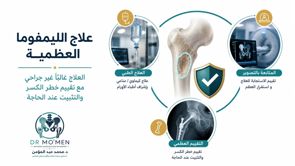 الليمفوما العظمية الأولية — صورة توضيحية داخل المقال رقم 4