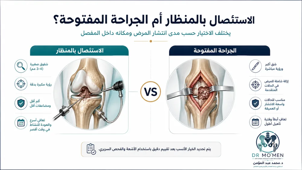 ورم الغشاء الزليلي PVNS / TGCT — صورة توضيحية داخل المقال رقم 3