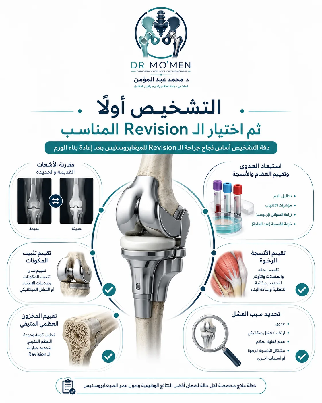 التخطيط لجراحة مراجعة المفصل الصناعي الضخم بمقارنة الأشعات واستبعاد العدوى وتقييم العظام
