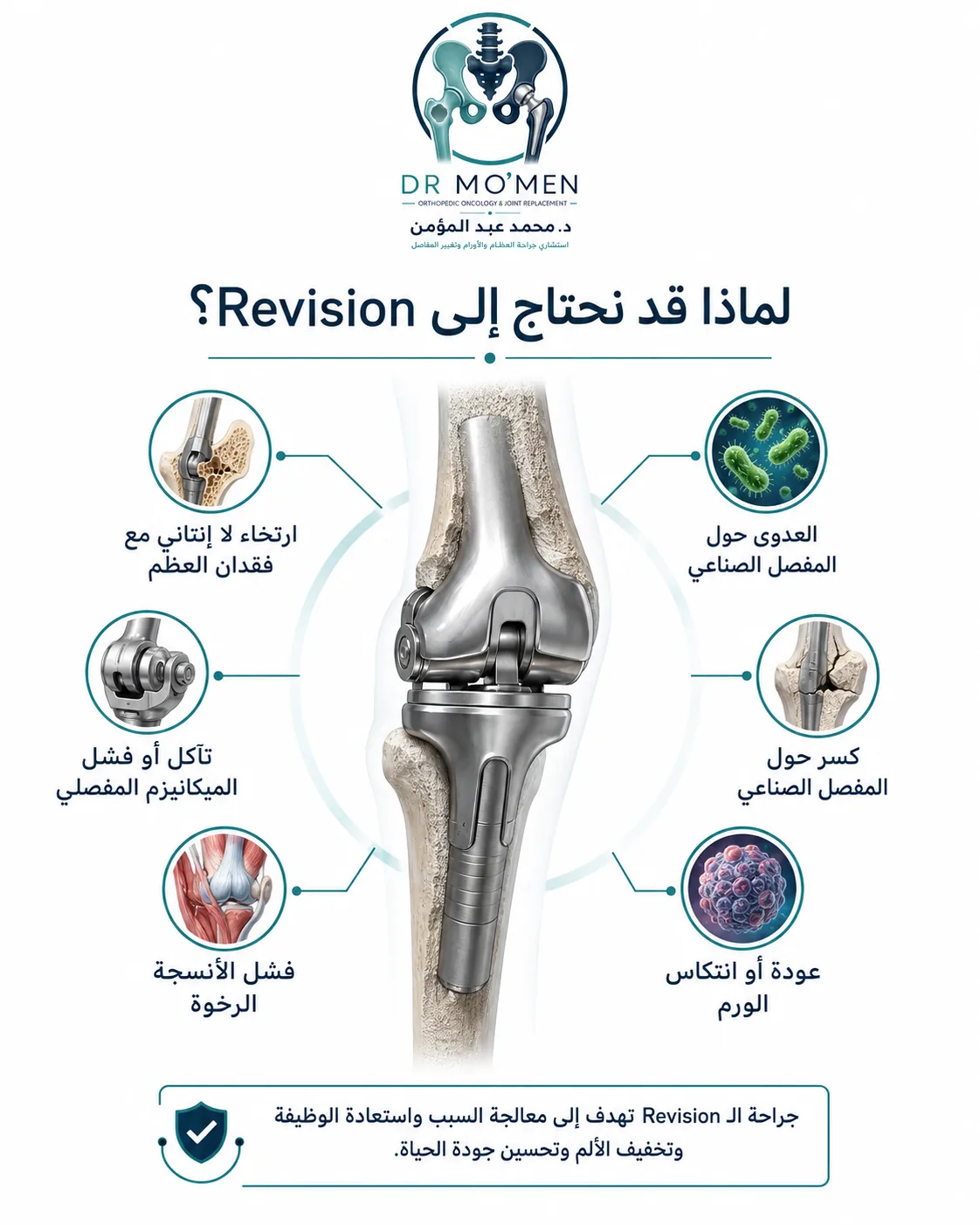 أسباب الحاجة إلى جراحة مراجعة المفصل الصناعي الضخم مثل الخلخلة والعدوى والكسر والعطل الميكانيكي