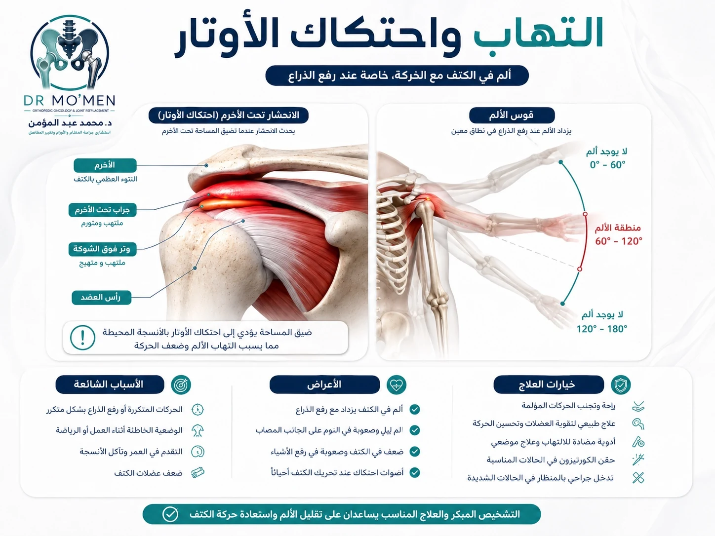 إنفوجرافيك يوضح التهاب أوتار الكتف واحتكاك الأوتار تحت عظمة الأخرم