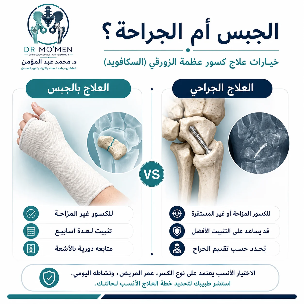 مقارنة بين علاج كسر الزورقية بالجبس والتثبيت الجراحي بحسب نوع الكسر واستقراره