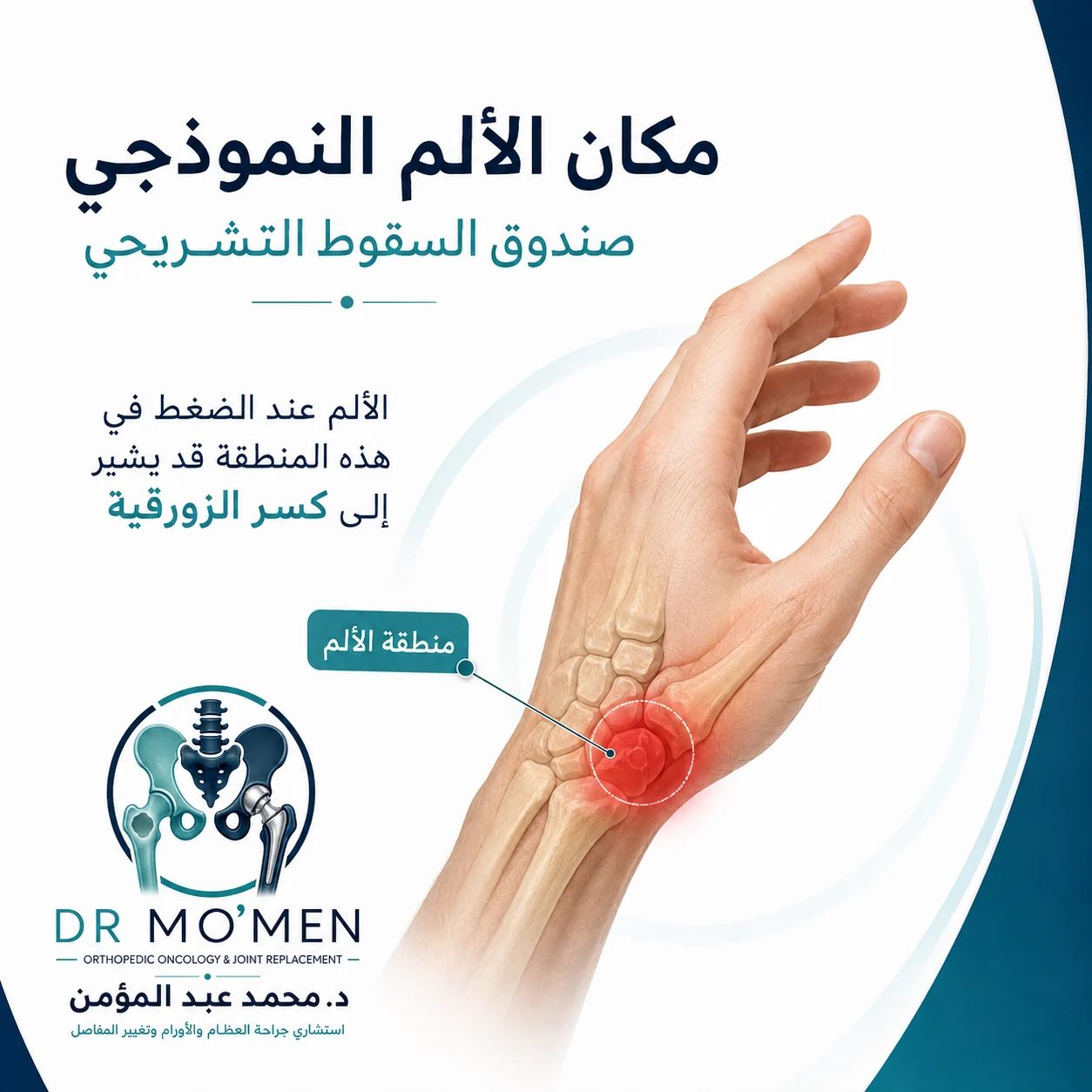 توضيح مكان الألم النموذجي في صندوق السعوط التشريحي عند قاعدة الإبهام
