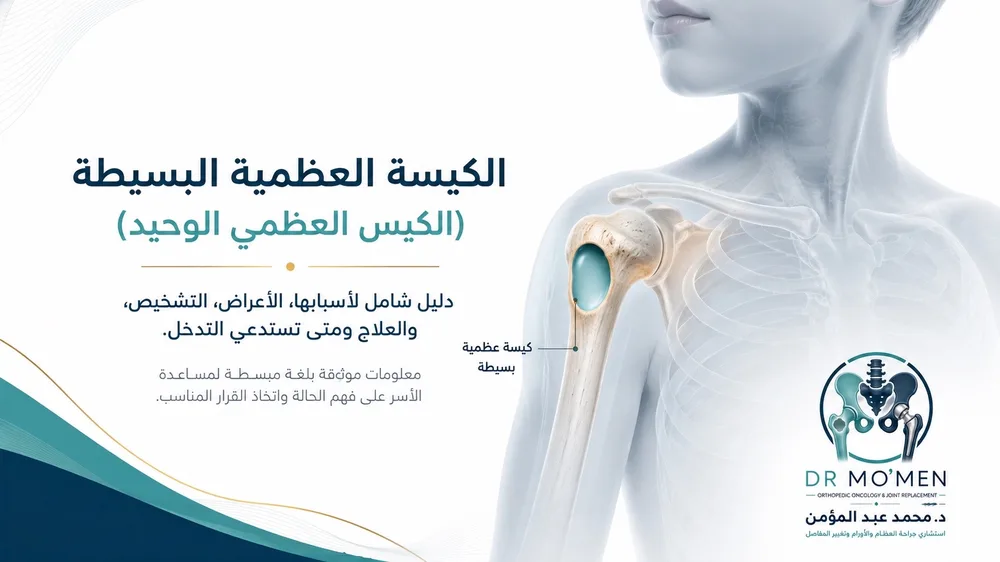 الكيس العظمي البسيط: متى يحتاج إلى متابعة أو علاج؟ — صورة توضيحية داخل المقال رقم 1