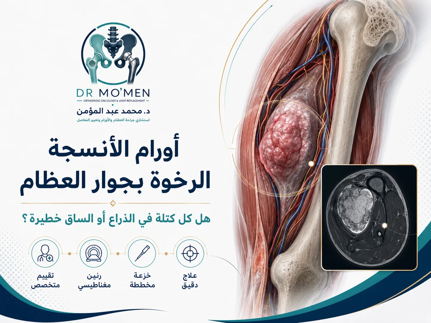 أورام الأنسجة الرخوة والكتل العميقة بجوار العظام ومتى تحتاج إلى تقييم متخصص