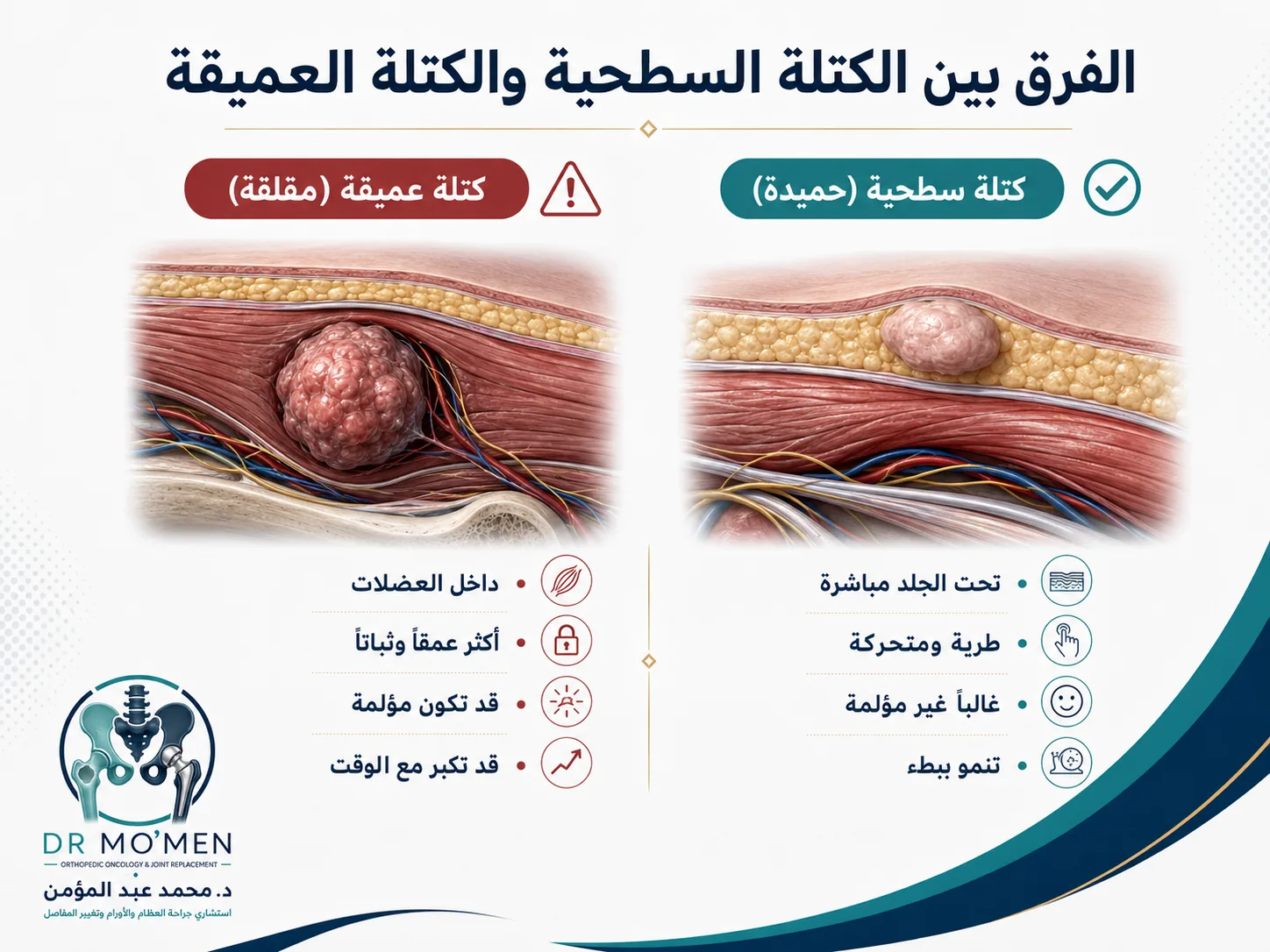 الفرق بين الكتلة السطحية الحميدة والكتلة العميقة المقلقة في الأنسجة الرخوة