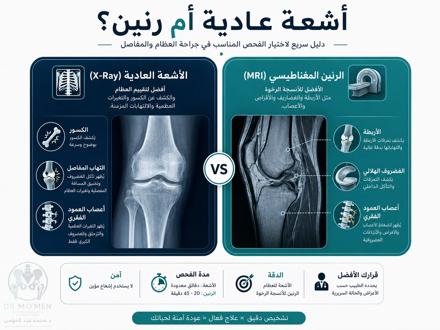 رسم توضيحي يقارن بين الأشعة العادية والرنين في تشخيص أمراض العظام