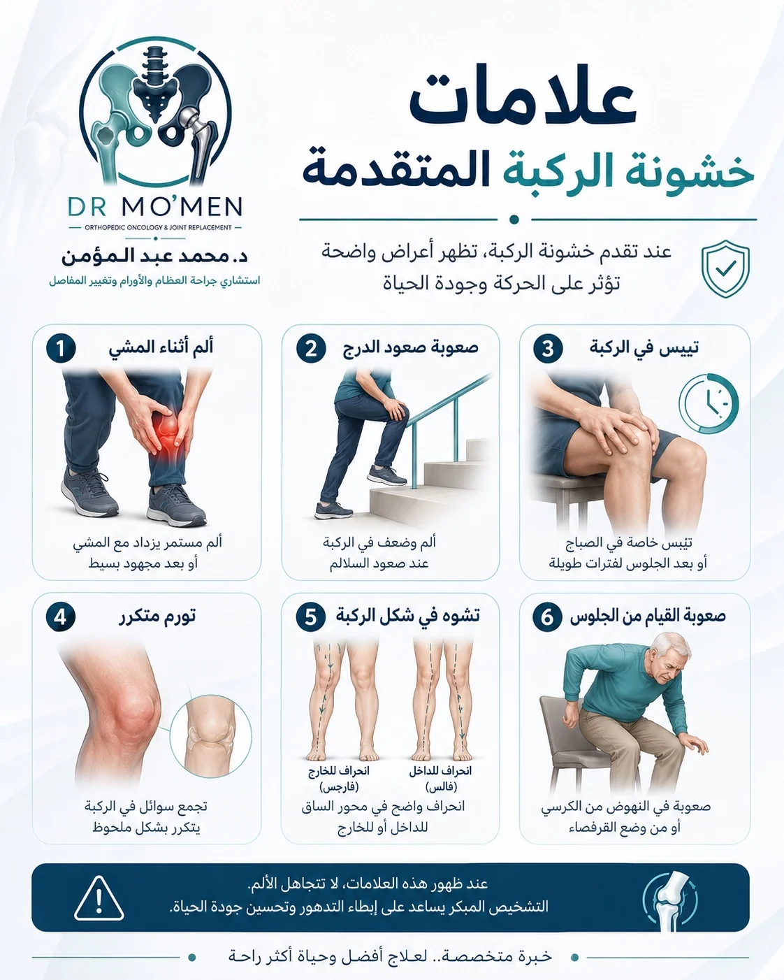 علامات خشونة الركبة المتقدمة مثل ألم المشي وصعوبة السلم والتيبس والاعوجاج
