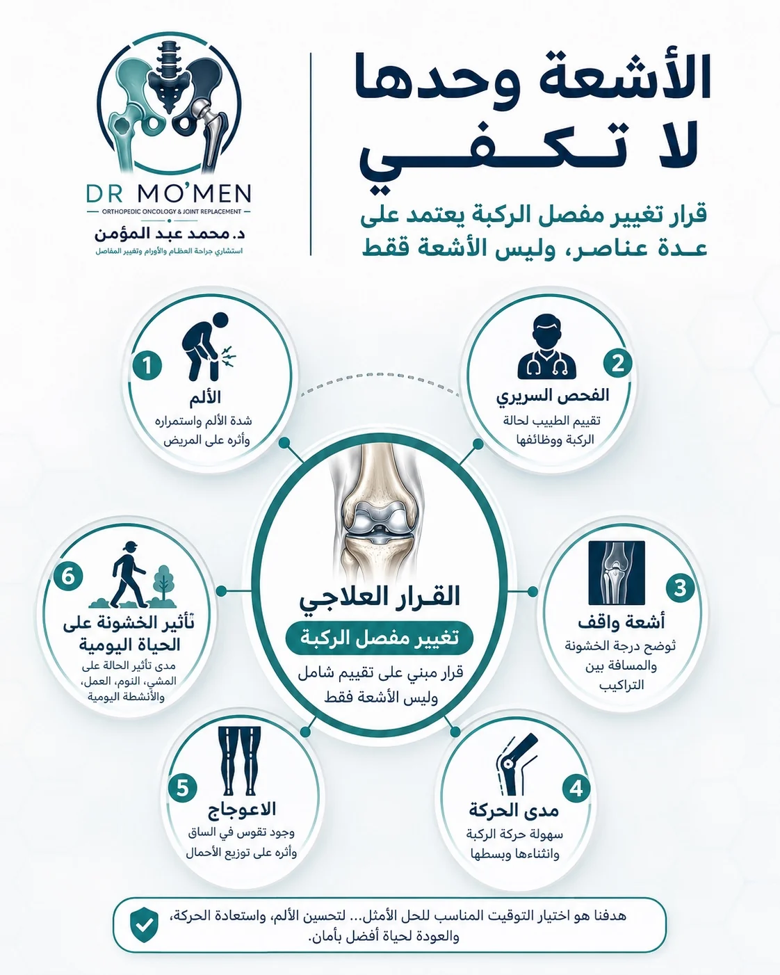 قرار تغيير مفصل الركبة يعتمد على الأشعة والفحص والألم وتأثير الخشونة على الحياة