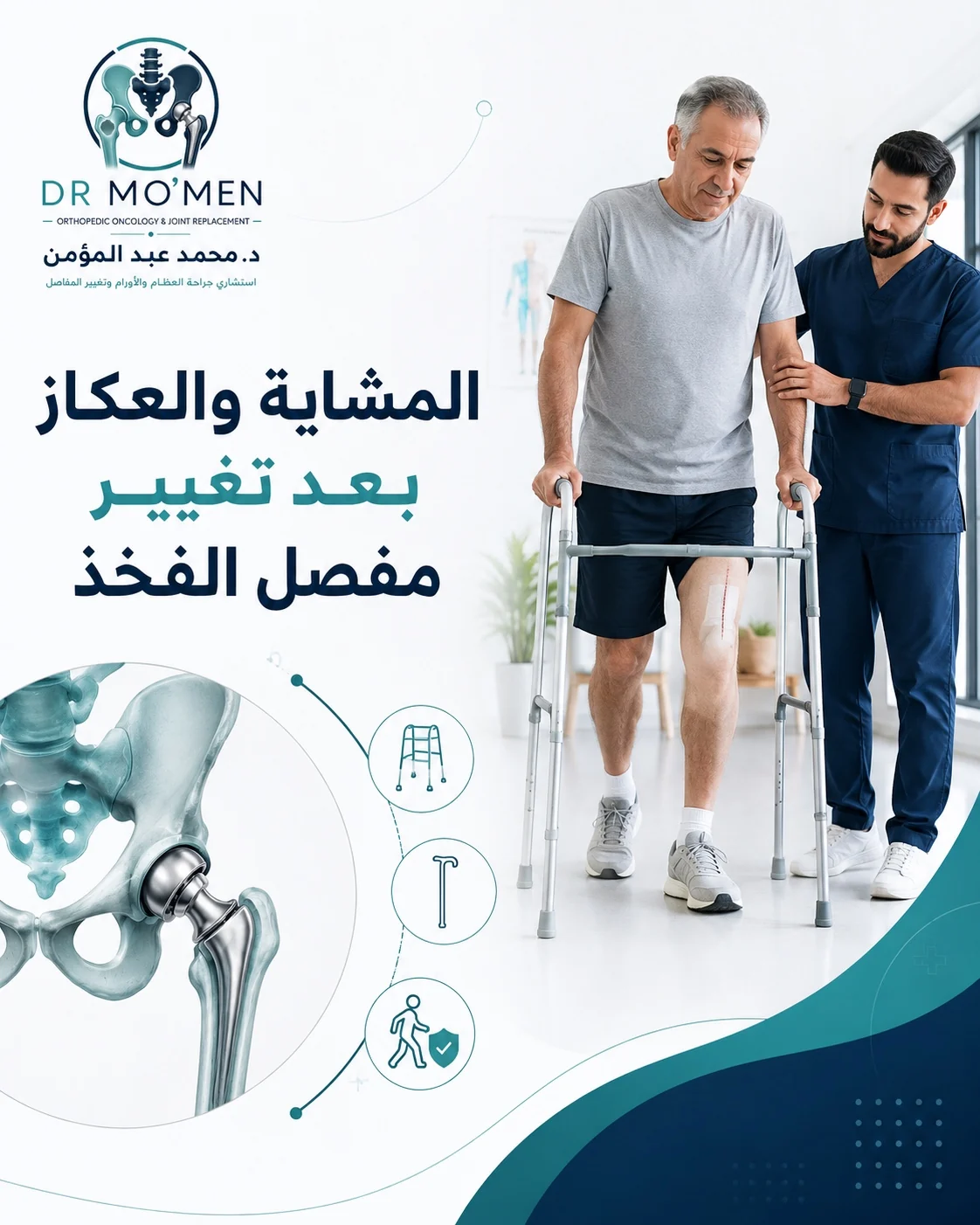 المشاية والعكاز بعد تغيير مفصل الفخذ ومتى يمكن المشي بدون مساعدة بأمان