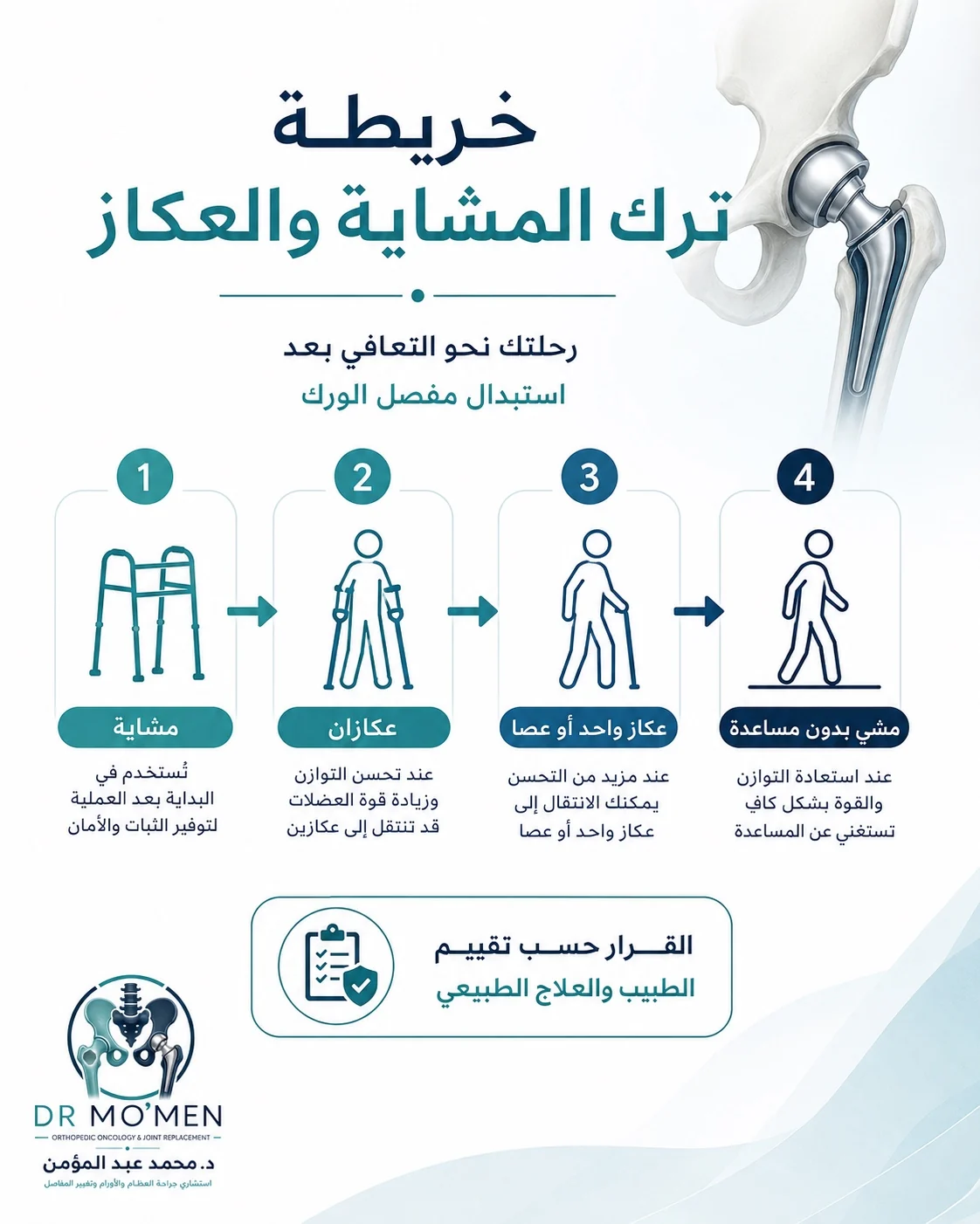 خريطة الانتقال من المشاية إلى العكاز ثم العصا ثم المشي بدون مساعدة بعد تغيير مفصل الفخذ
