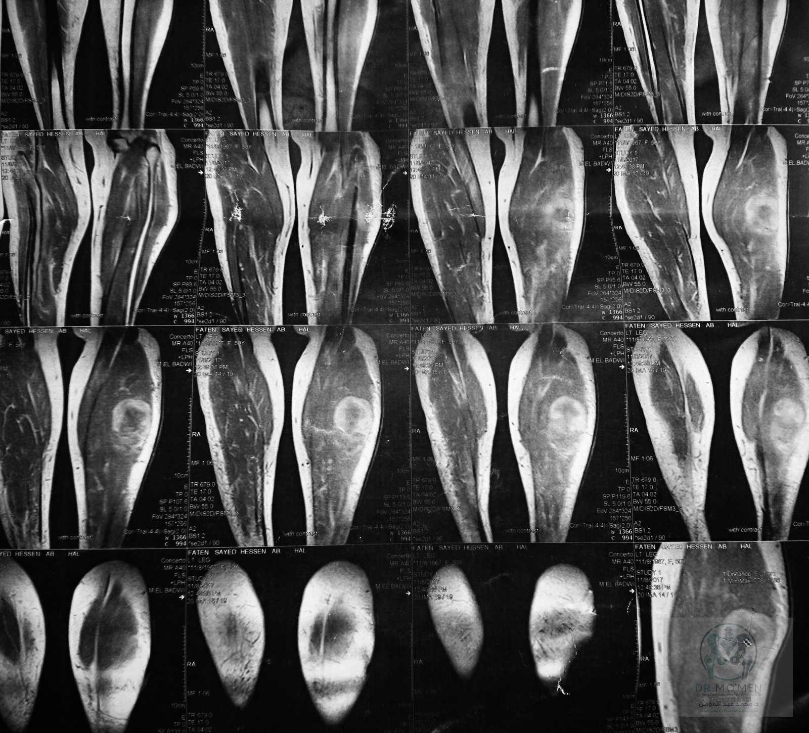 Additional longitudinal MRI view preserving the complete original field of view.