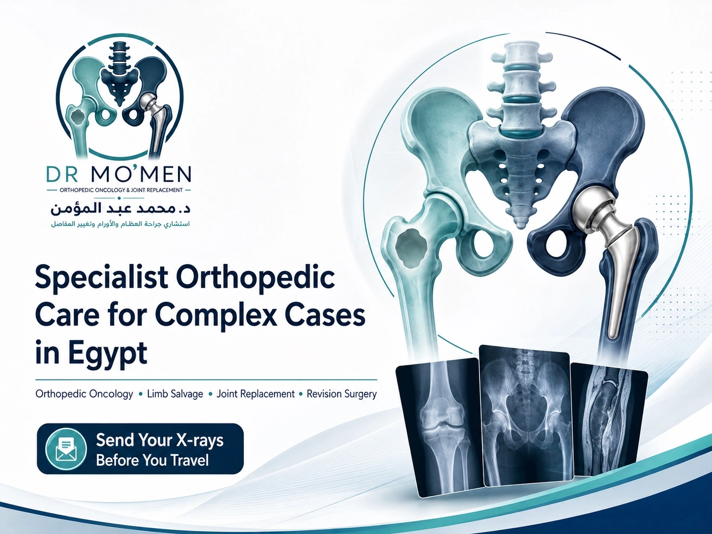 Specialist orthopedic care in Egypt for international patients with complex orthopedic conditions