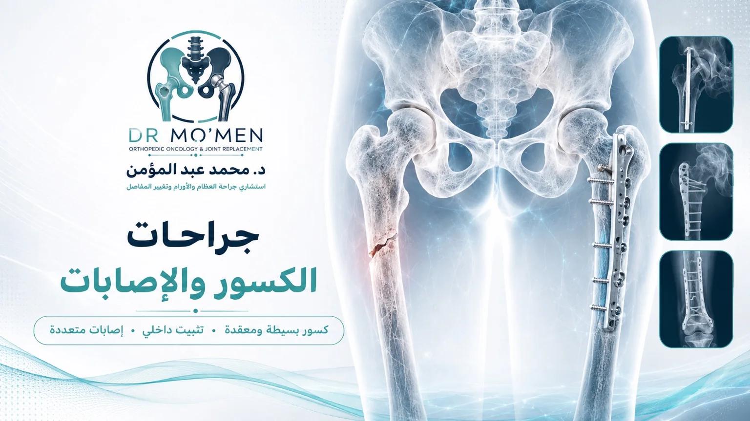 Fracture fixation and complex trauma surgery