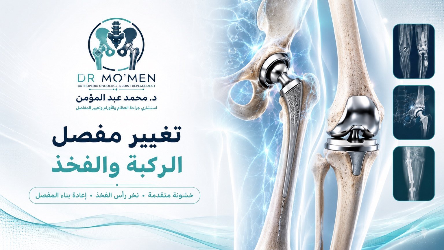 Hip and knee joint replacement surgery